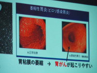 P7140064